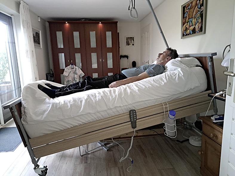 Head-Up Tilt Sleeping to Treat Orthostatic Intolerance in a Patient with Advanced Parkinson's Disease: A Case Report.