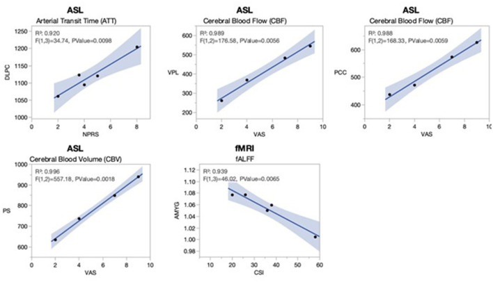 Multimodal functional imaging and clinical correlates of pain regions in chronic low-back pain patients treated with spinal cord stimulation: a pilot study.