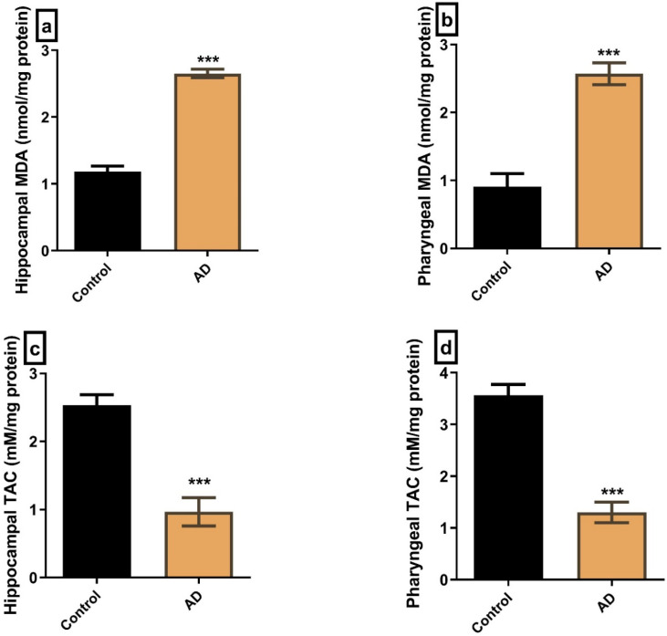 Structural Changes in Pharyngeal and Tongue Muscles as a Potential Contributor to Dysphagia in Alzheimer Disease Rat Model.