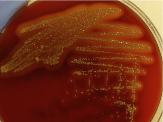 Outbreak of dermatophilosis in horses possibly transmitted by sharing riding equipment.