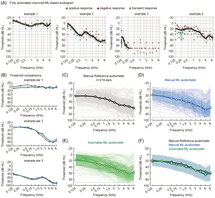 Performance and reliability evaluation of an improved machine learning-based pure-tone audiometry with automated masking.