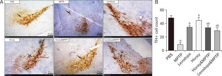 Honey and levodopa comparably preserved substantia nigra pars compacta neurons through the modulation of nuclear factor erythroid 2-related factor 2 signaling pathway in 1-methyl-4-phenyl-1,2,3,6-tetrahydropyridine-induced Parkinson's disease model.