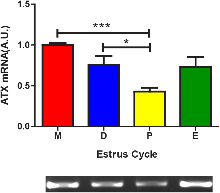 Autotaxin Expression in the Uterus of Cycling Rats.