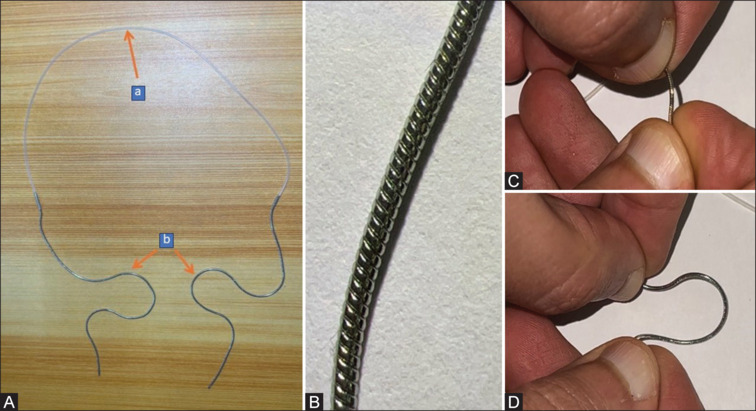 A Novel Snake-chain Metal Probed Silicon Intubation Set for Nasolacrimal Duct Intubation: A Cadaveric Feasibility Study.