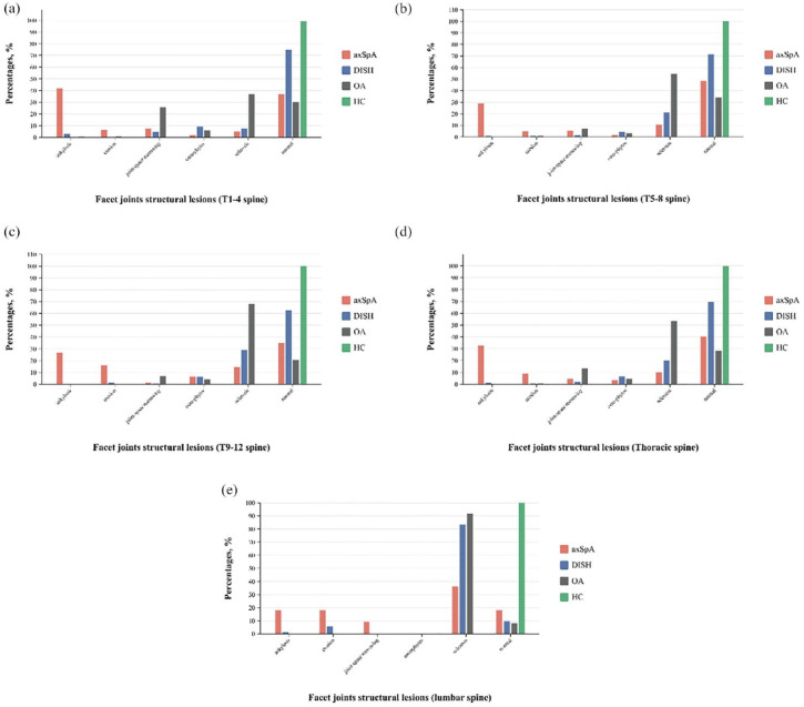 Distinct characteristics and progression patterns of facet joint structural lesions in radiographic axial spondyloarthritis.
