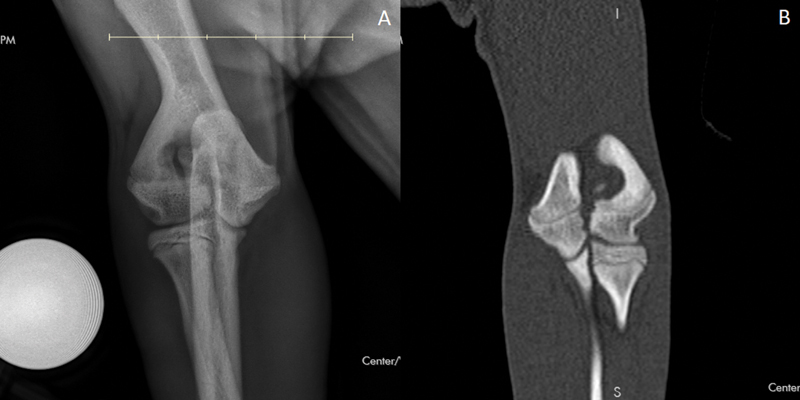 Humeral Condylar Fractures in French Bulldogs: Prevalence of Contralateral Intracondylar Fissure, Treatment, and Outcome.