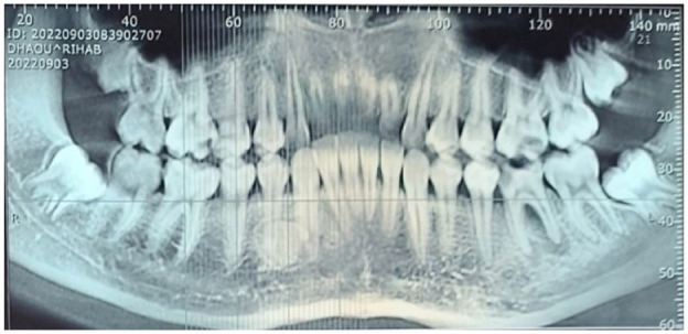 Abstract Image