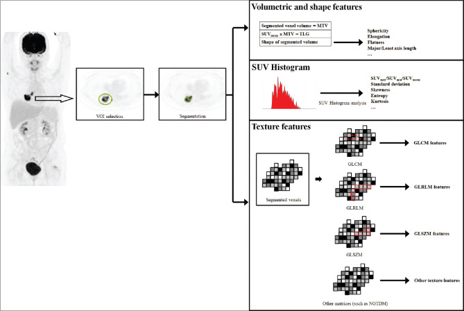 The value of <sup>18</sup>F-fluorodeoxyglucose positron emission tomography-based radiomics in non-small cell lung cancer.