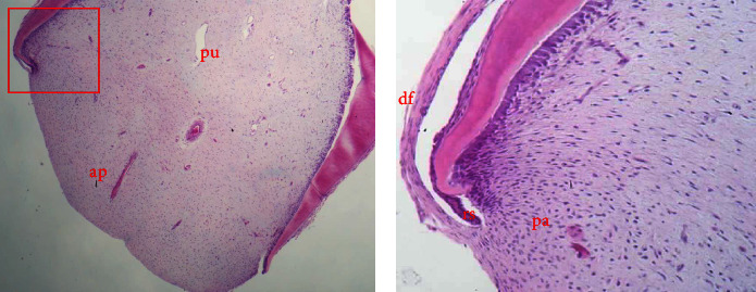 The Differentiation Potential of Apical Papilla Cells in Relation to Tenascin-C and Syndecan-1 Expression and Their Potential Role in Regeneration.