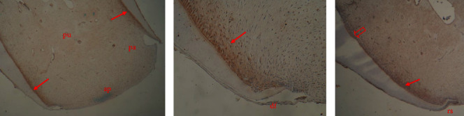 The Differentiation Potential of Apical Papilla Cells in Relation to Tenascin-C and Syndecan-1 Expression and Their Potential Role in Regeneration.