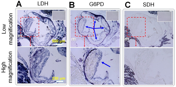 <i>In Situ</i> Mapping of the Glucose Metabolism Heterogeneity in Atherosclerosis: Correlation With 2-Deoxyglucose Uptake.