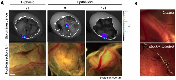 Volatile organic compound analysis of malignant pleural mesothelioma chorioallantoic membrane xenografts.