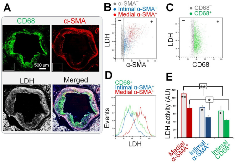 <i>In Situ</i> Mapping of the Glucose Metabolism Heterogeneity in Atherosclerosis: Correlation With 2-Deoxyglucose Uptake.