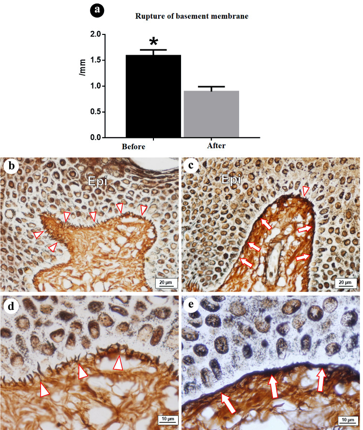 Physiological Stimulus for the Synthesis of Basement Membrane Proteins Leading to Its Reconstruction.