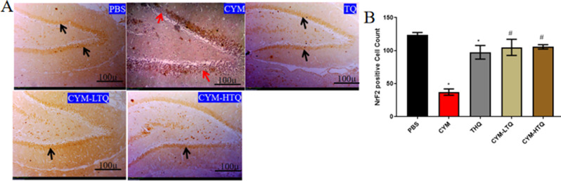 Thymoquinone ameliorate oxidative stress, GABAergic neuronal depletion and memory impairment through Nrf2/ARE signaling pathway in the dentate gyrus following cypermethrin administration.