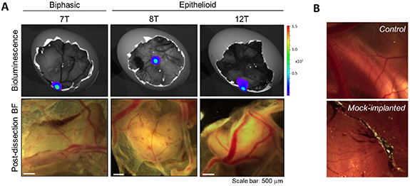 Volatile organic compound analysis of malignant pleural mesothelioma chorioallantoic membrane xenografts.