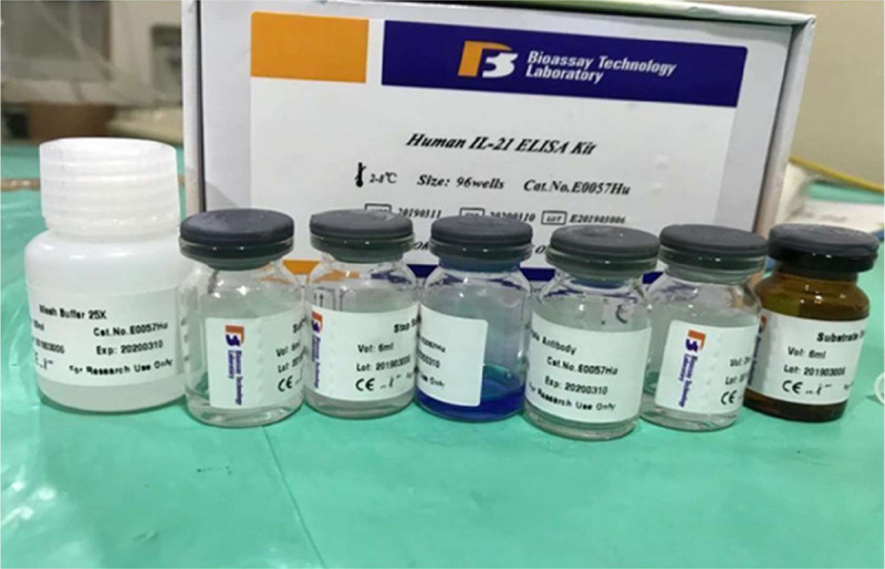 Comparative evaluation of serum and gingival crevicular fluid levels of interleukin 21 in periodontally diseased and healthy patients.