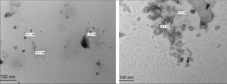 Quercetin diminishes the apoptotic pathway of magnetite nanoparticles in rats' ovary: Antioxidant status and hormonal profiles.