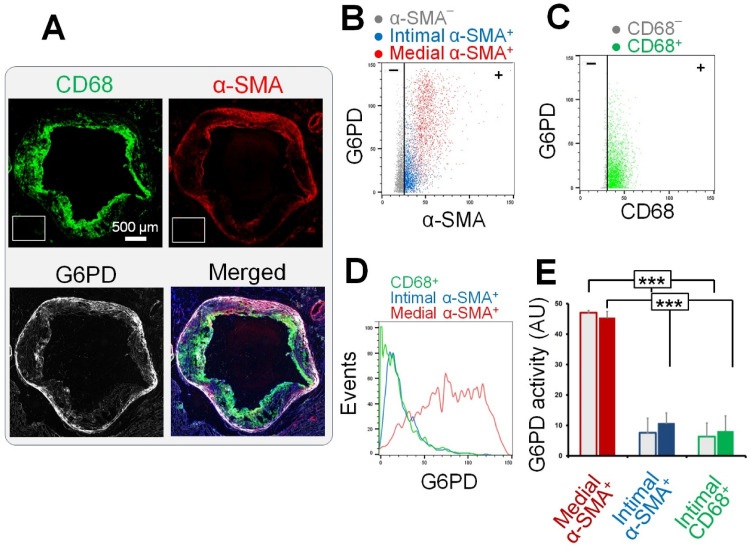 <i>In Situ</i> Mapping of the Glucose Metabolism Heterogeneity in Atherosclerosis: Correlation With 2-Deoxyglucose Uptake.