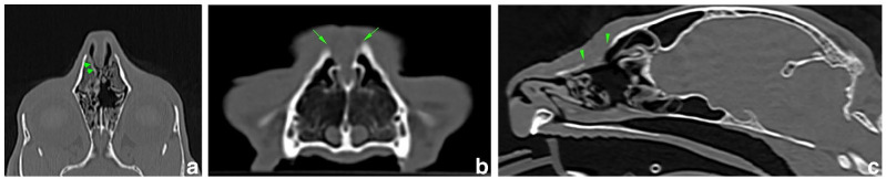 Excision of a nasal dermoid sinus cyst and primary reconstruction using an autologous fascia lata graft in a cat.