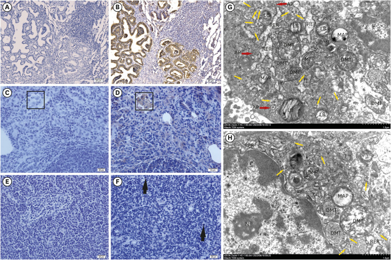 Identification of concurrent infection with Jaagsiekte sheep retrovirus and maedi-visna virus in China.