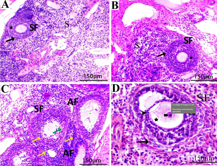Quercetin diminishes the apoptotic pathway of magnetite nanoparticles in rats' ovary: Antioxidant status and hormonal profiles.