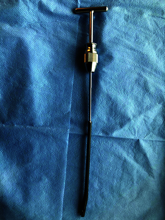 A Novel Technique to Remove a Tibial Nail.