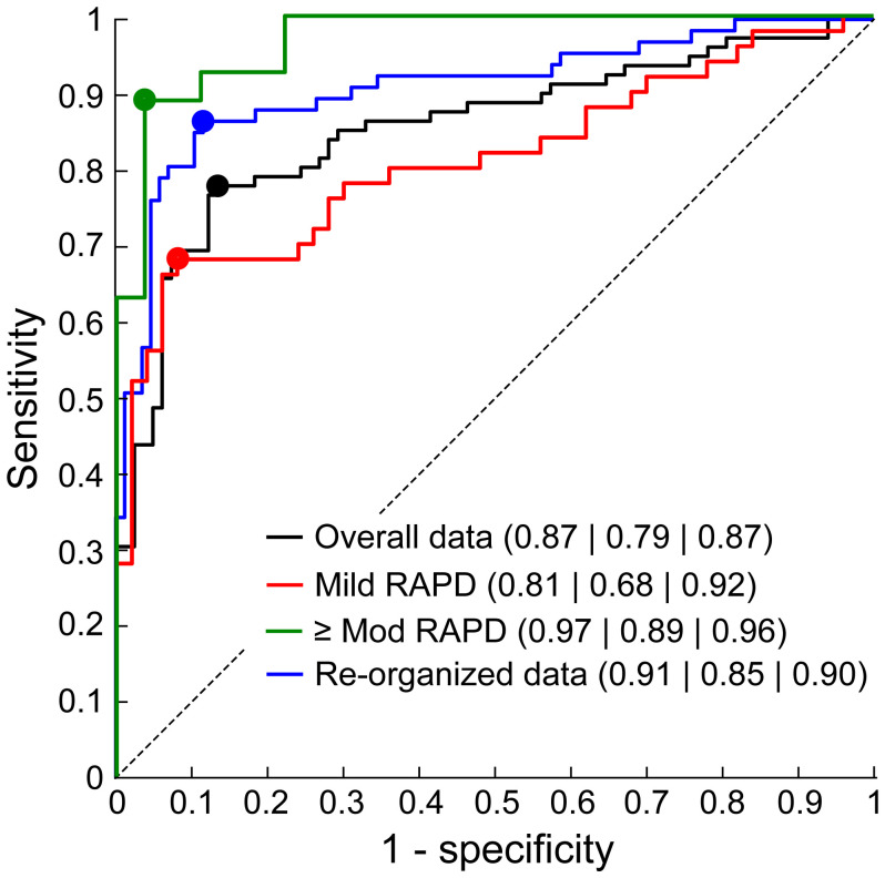 Diagnostic accuracy of a modularized, virtual-reality-based automated pupillometer for detection of relative afferent pupillary defect in unilateral optic neuropathies.