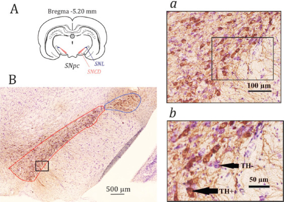 The neuronal density in the rostral pole of substantia nigra pars compacta in Wistar Albino rats from Rijswijk rats: A link to spike-wave seizures.