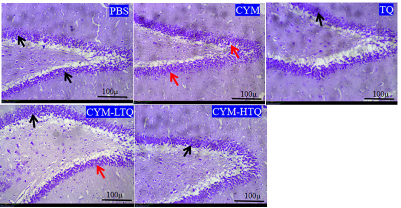 Thymoquinone ameliorate oxidative stress, GABAergic neuronal depletion and memory impairment through Nrf2/ARE signaling pathway in the dentate gyrus following cypermethrin administration.