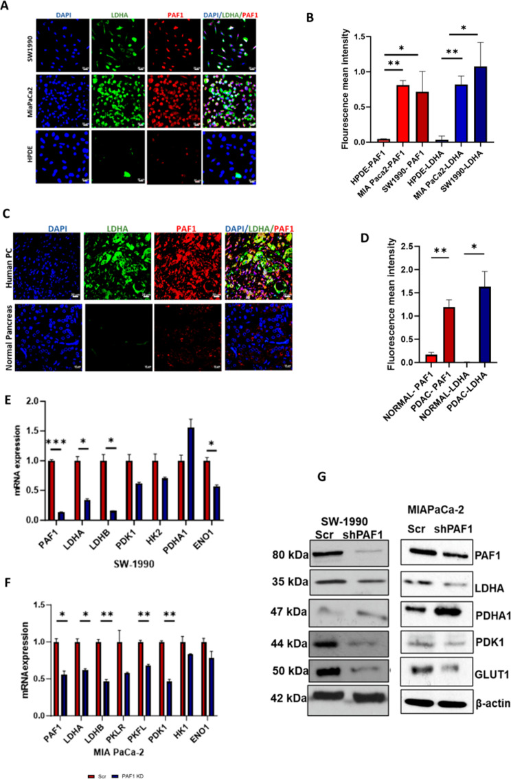 PAF1/HIF1α axis rewires the glycolytic metabolism to fuel aggressiveness of pancreatic cancer.
