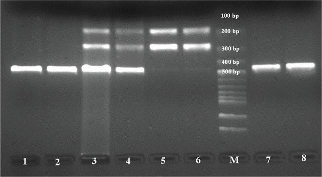 Evaluation of the relationship between <i>ACE2 G8790A</i> and <i>AT2R A1675G</i> gene polymorphisms in COVID-19 patients with and without lung involvement.