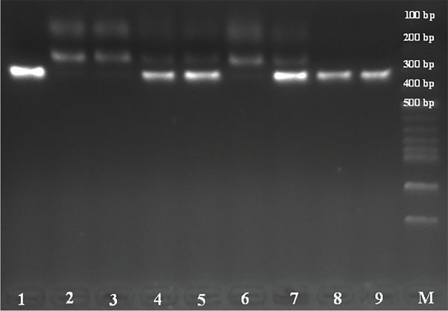 Evaluation of the relationship between <i>ACE2 G8790A</i> and <i>AT2R A1675G</i> gene polymorphisms in COVID-19 patients with and without lung involvement.
