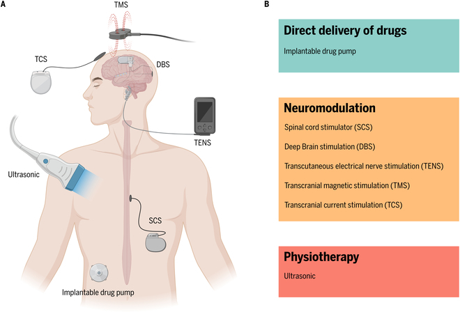 Sensors and Devices Guided by Artificial Intelligence for Personalized Pain Medicine.