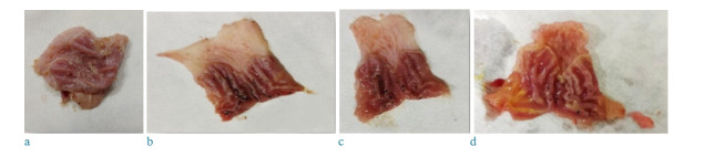 Gastroprotective Effects of Betahistine Against an Indomethacin-Induced Gastric Mucosal Ulcer in Rats: The Role of CINC-2α Gene.