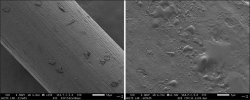 Evaluation of surface roughness, cytotoxicity, and antibacterial effects of silver nanoparticle coating on copper nickel titanium orthodontic arch wires - <i>in vitro</i> study.