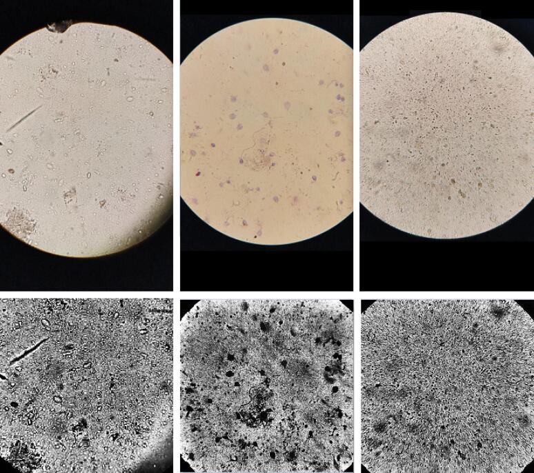 Automatic classification of <i>Giardia</i> infection from stool microscopic images using deep neural networks.