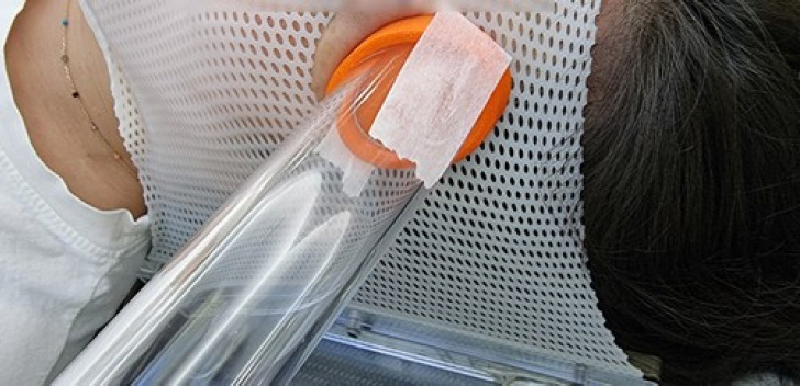 Skin-directed radiotherapy for primary cutaneous T-cell lymphomas.