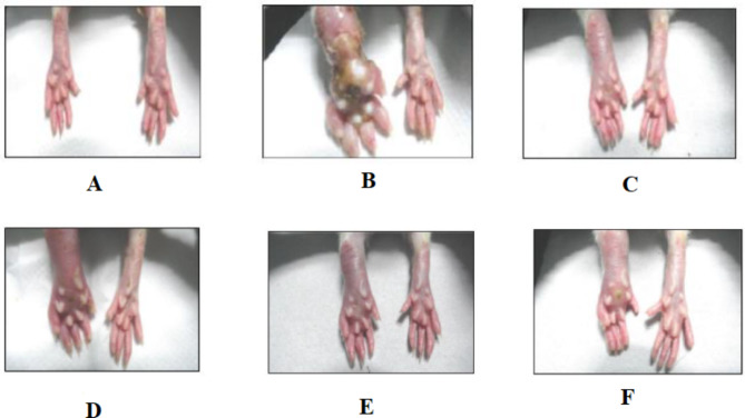 Anti-inflammatory and anti-arthritic activities of ethanolic extract of Myxopyrum serratulum A.W. Hill.