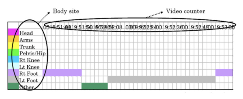 The level of skills involved in an observation-based gait analysis.