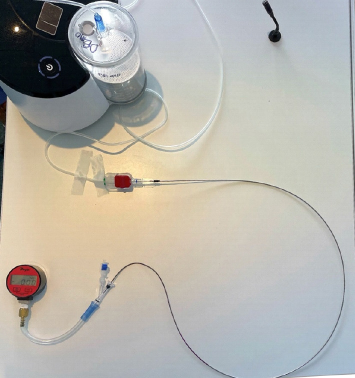 Optimizing suction force in mechanical thrombectomy: Priming the aspiration tubing with air versus saline.