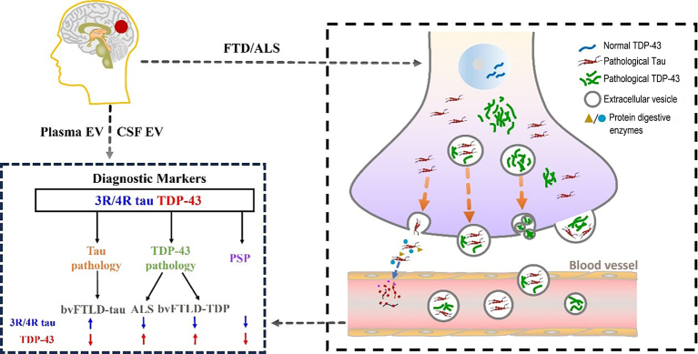 Plasma extracellular vesicle: a novel biomarker for neurodegenerative disease diagnosis.