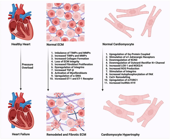 Pulmonary Hypertension and Right Ventricle: A Pathophysiological Insight.