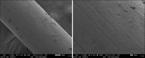 Evaluation of surface roughness, cytotoxicity, and antibacterial effects of silver nanoparticle coating on copper nickel titanium orthodontic arch wires - <i>in vitro</i> study.