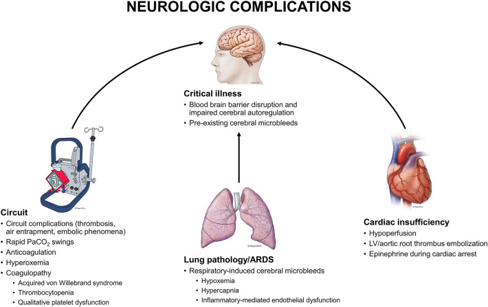 Short-Term Neurologic Complications in Patients Undergoing Extracorporeal Membrane Oxygenation Support: A Review on Pathophysiology, Incidence, Risk Factors, and Outcomes.