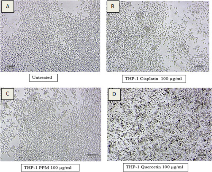 In-vitro scientific validation of anti-inflammatory activity of <i>Punica granatum L.</i> on Leukemia monocytic cell line.