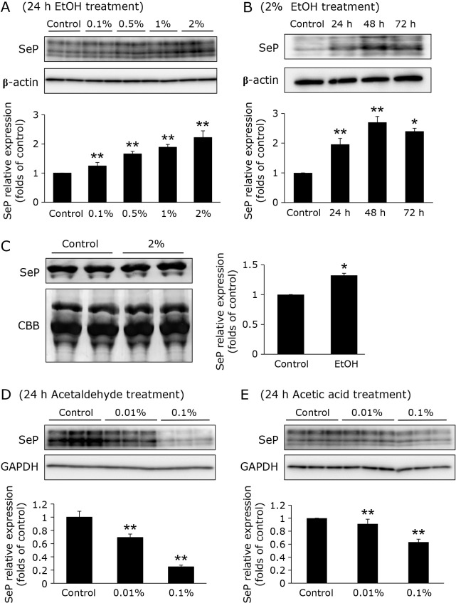 Ethanol enhances selenoprotein P expression via ERK-FoxO3a axis in HepG2 cells.
