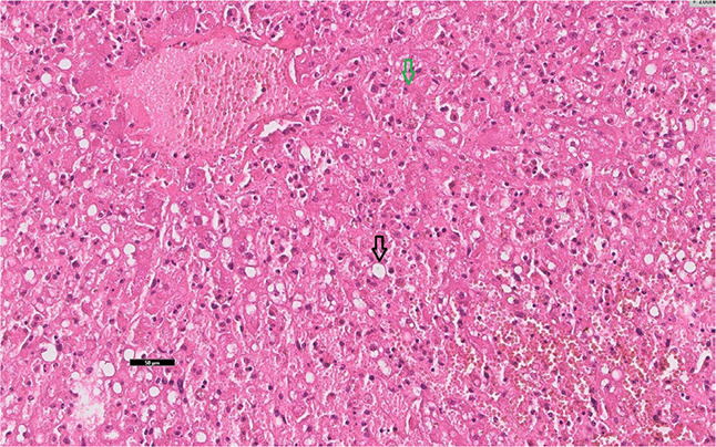 <i>Senecio ovatus</i> poisoning in a horse - A case report.