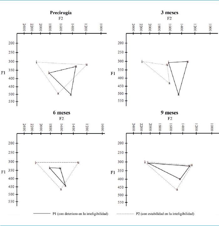 [Vowel articulation and intelligibility of speech in Spanish speakers with Parkinson's disease treated with deep brain stimulation of the subthalamic nucleus].