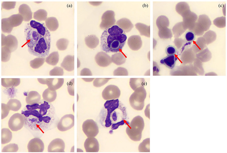 A Simple, Fast, and Reliable Method for the Identification of <i>Candida albicans</i>.